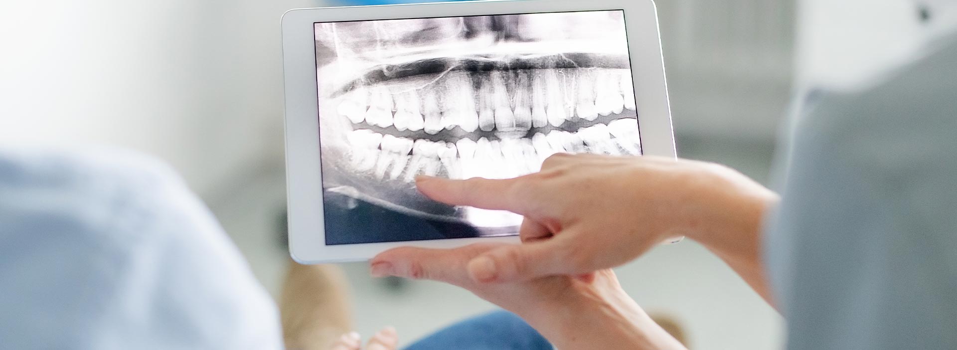 A person using a tablet with an X-ray displayed on the screen while holding a dental model.