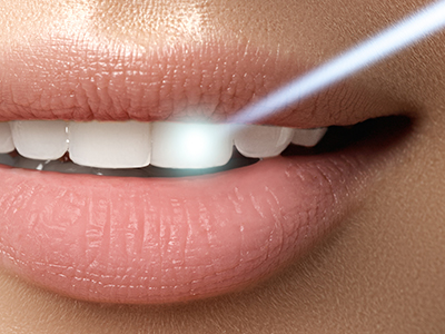 The image shows a close-up of a person's face with a focus on their teeth and lips, with a bright light source emanating from their mouth, possibly suggesting a dental hygiene product or technology in use.